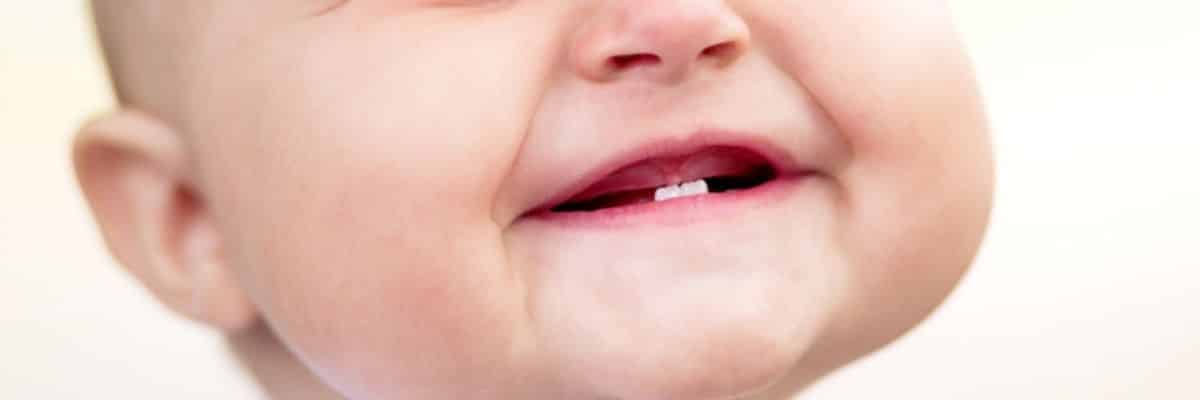 Bebés nacen con dientes!